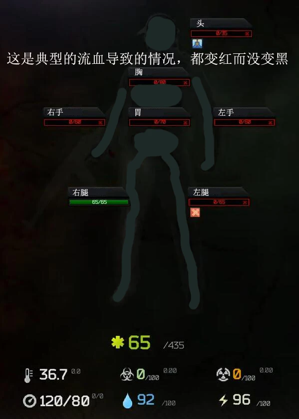 逃离塔科夫角色怎么恢复健康,提高生存率